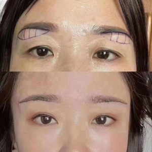 精细无痕粘眉术前后对比图