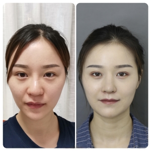 妈生鼻私人订制