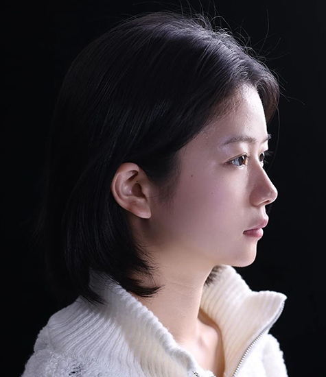 隆鼻整形手术之后